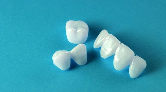 Met facings maakt tandarts G.L. van den Berg scheve tanden weer recht.